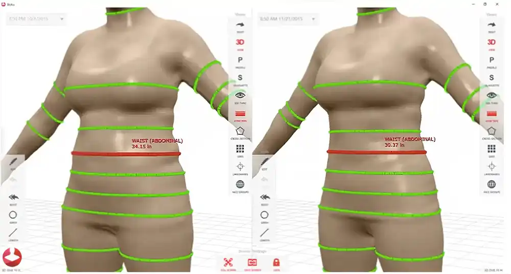 monitor view of Styku 3Dc
