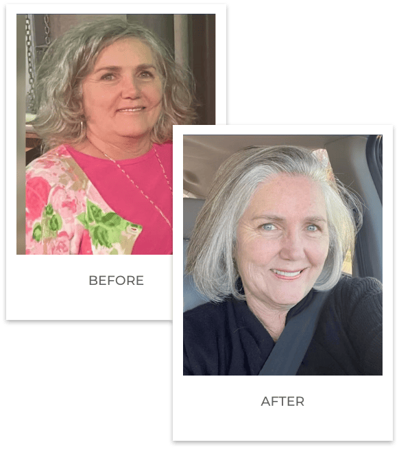 Before and after weight loss photo