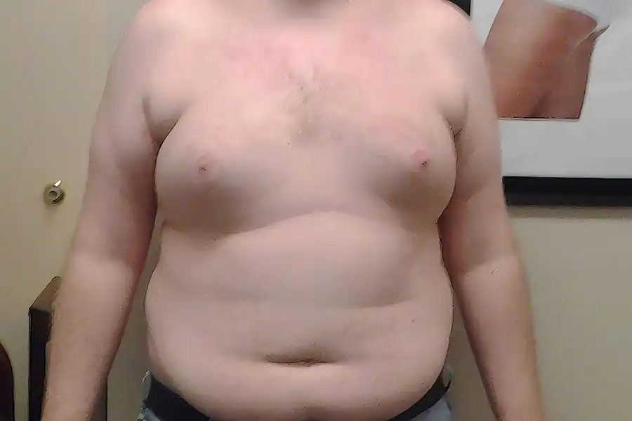 before weight loss photo of a man's upper body