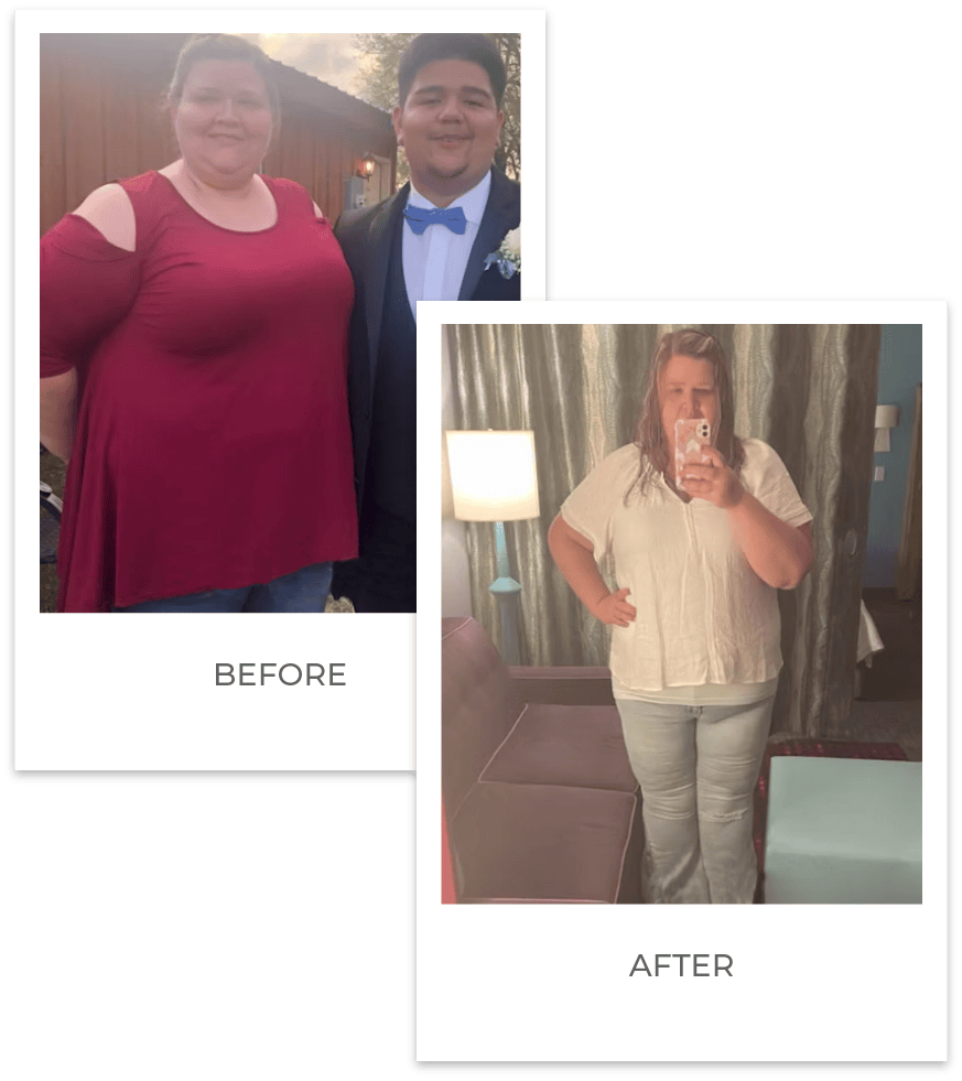 weight loss before and after